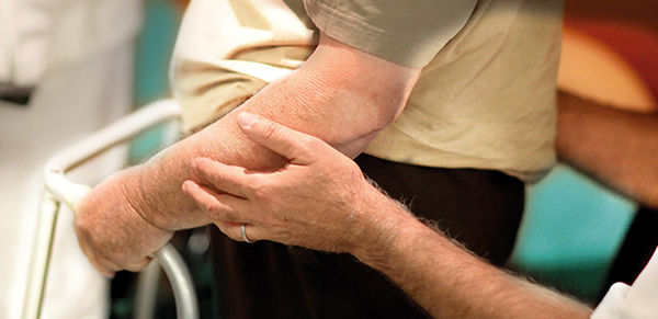 EHPAD : la prise en charge MGEN EHPAD : la prise en charge MGEN